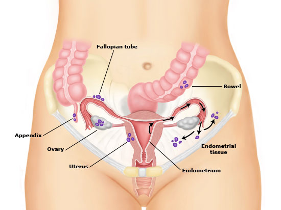 Endometrium dokusu vücutta en çok nerelerde bulunur?