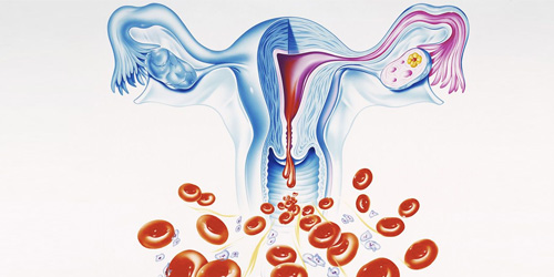 Endometrium (rahim) kanseri en sık rastlanan belirtisi kanamadır.