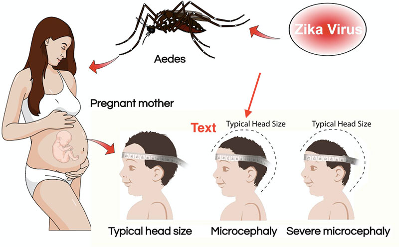 Zika virüsü hastalığı çoğunlukla sivrisinekler tarafından yayılır. Risk çok düşük olmasına rağmen, seks yoluyla da bulaşabilir. 
